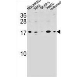 S100 Calcium Binding Protein Z (S100Z) Antibody