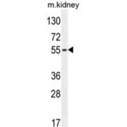 F-Box Only Protein 39 (FBXO39) Antibody