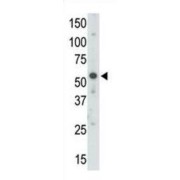 Ubiquitin-Like Modifier-Activating Enzyme 3 (UBE1C) Antibody