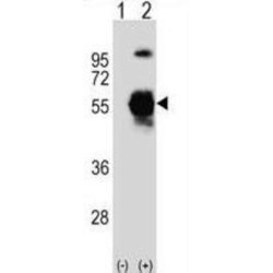 Ubiquitin-Like Modifier-Activating Enzyme 3 (UBE1C) Antibody