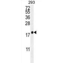 PCOTH Antibody