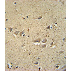 Sodium Voltage-Gated Channel Beta Subunit 1 (SCN1B) Antibody