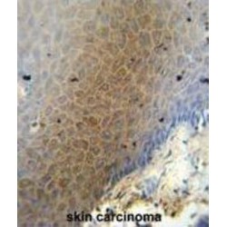 Centrosomal Protein 70 kDa (CEP70) Antibody