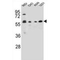 Centrosomal Protein 70 kDa (CEP70) Antibody