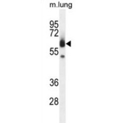 Zinc Finger With UFM1-Specific Peptidase Domain Protein (ZUFSP) Antibody