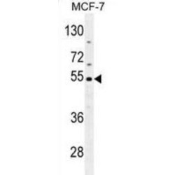 Cocaine Esterase (CES2) Antibody