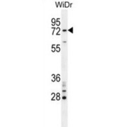 BRCA1-Associated RING Domain Protein 1 (BARD1) Antibody