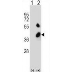 2-Oxoisovalerate Dehydrogenase Subunit Beta, Mitochondrial (BCKDHB) Antibody