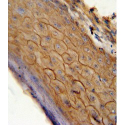 Cannabinoid Receptor 2 (CB2) Antibody