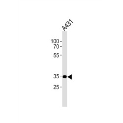 Cannabinoid Receptor 2 (CB2) Antibody