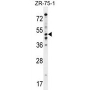 Phosphodiesterase 7B (PDE7B) Antibody