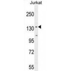 Protein Phosphatase 1 Regulatory Subunit 3A (PPP1R3A) Antibody