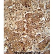 Serum Amyloid P-Component (APCS) Antibody