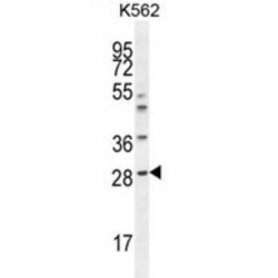 Serum Amyloid P-Component (APCS) Antibody