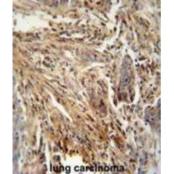 Granulocyte-Macrophage Colony-Stimulating Factor (CSF2) Antibody