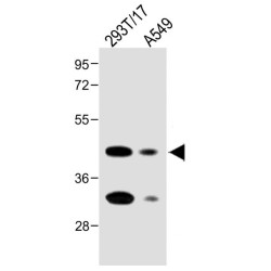 Folate Receptor Alpha (FOLR1) Antibody