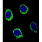 Alpha-Amylase 2B (AMY2B) Antibody