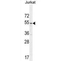 Membrane Protein, Palmitoylated 1 (MPP1) Antibody