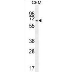 COX11, Cytochrome C Oxidase Copper Chaperone (COX10) Antibody