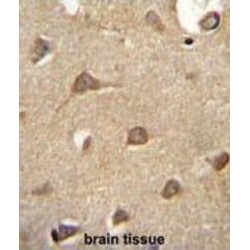 Ectonucleoside Triphosphate Diphosphohydrolase 3 (ENTPD3) Antibody