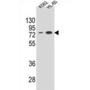 WB analysis of K562 and HL-60 cell line lysates.