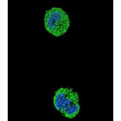 Protein C-Ets-1 (ETS1) Antibody