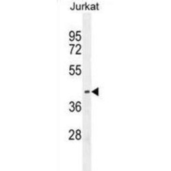 Protein C-Ets-1 (ETS1) Antibody