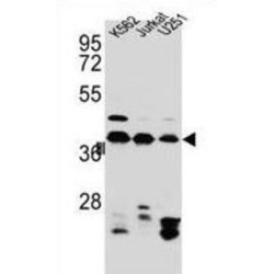 Heterogeneous Nuclear Ribonucleoprotein C1/C2 (HNRNPC) Antibody