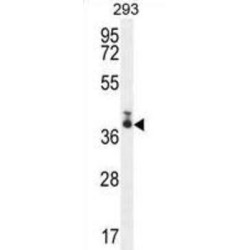 Transmembrane Protein 66 (TMEM66) Antibody