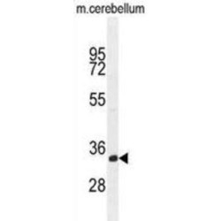 Transmembrane Protein 66 (TMEM66) Antibody