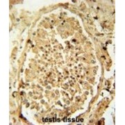 Pyruvate Dehydrogenase E1 Component Subunit Alpha, Testis-Specific Form, Mitochondrial (PDHA2) Antibody