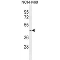 Pyruvate Dehydrogenase E1 Component Subunit Alpha, Testis-Specific Form, Mitochondrial (PDHA2) Antibody