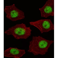 LIM Domain Only 4 (LMO4) Antibody