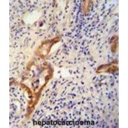 ATP-Dependent Clp Protease ATP-Binding Subunit ClpX-Like, Mitochondrial (CLPX) Antibody