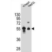 Dipeptidase 3 (DPEP3) Antibody