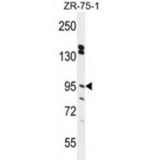 Endoplasmic Reticulum Metallopeptidase 1 (ERMP1) Antibody