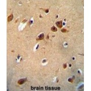 Pleckstrin Homology Domain-Containing Family G Member 1 (PKHG1) Antibody