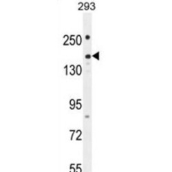 Pleckstrin Homology Domain-Containing Family G Member 1 (PKHG1) Antibody