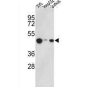 Histone Acetyltransferase Type B Catalytic Subunit (KAT1) Antibody