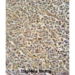 Zinc Finger Protein 180 (ZN180) Antibody