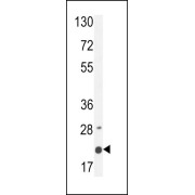 Western Blot analysis of MDA-MB435 cell lysates (35 µg per lane) using M4A4A Antibody.