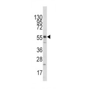 KAT5 / Tip60 / HTATIP Antibody