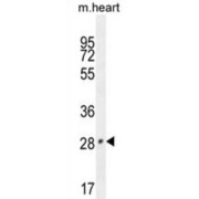 Transcription Cofactor Vestigial-Like Protein 2 (VGLL2) Antibody