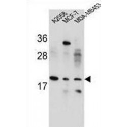 Variable Charge X-Linked Protein 1 (VCX1) Antibody