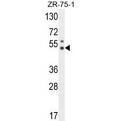 Pseudouridylate Synthase 3 (PUS3) Antibody