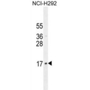 Western blot analysis of NCI-H292 cell lysates (35 µg per lane) using Protein LLP Homolog (LLPH) Antibody.