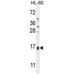 TCL6 Antibody