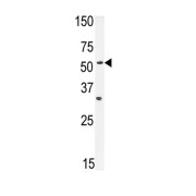 Equilibrative Nucleoside Transporter 1 (ENT1) Antibody