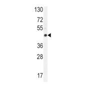 Equilibrative Nucleoside Transporter 1 (ENT1) Antibody