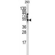 Equilibrative Nucleoside Transporter 1 (ENT1) Antibody